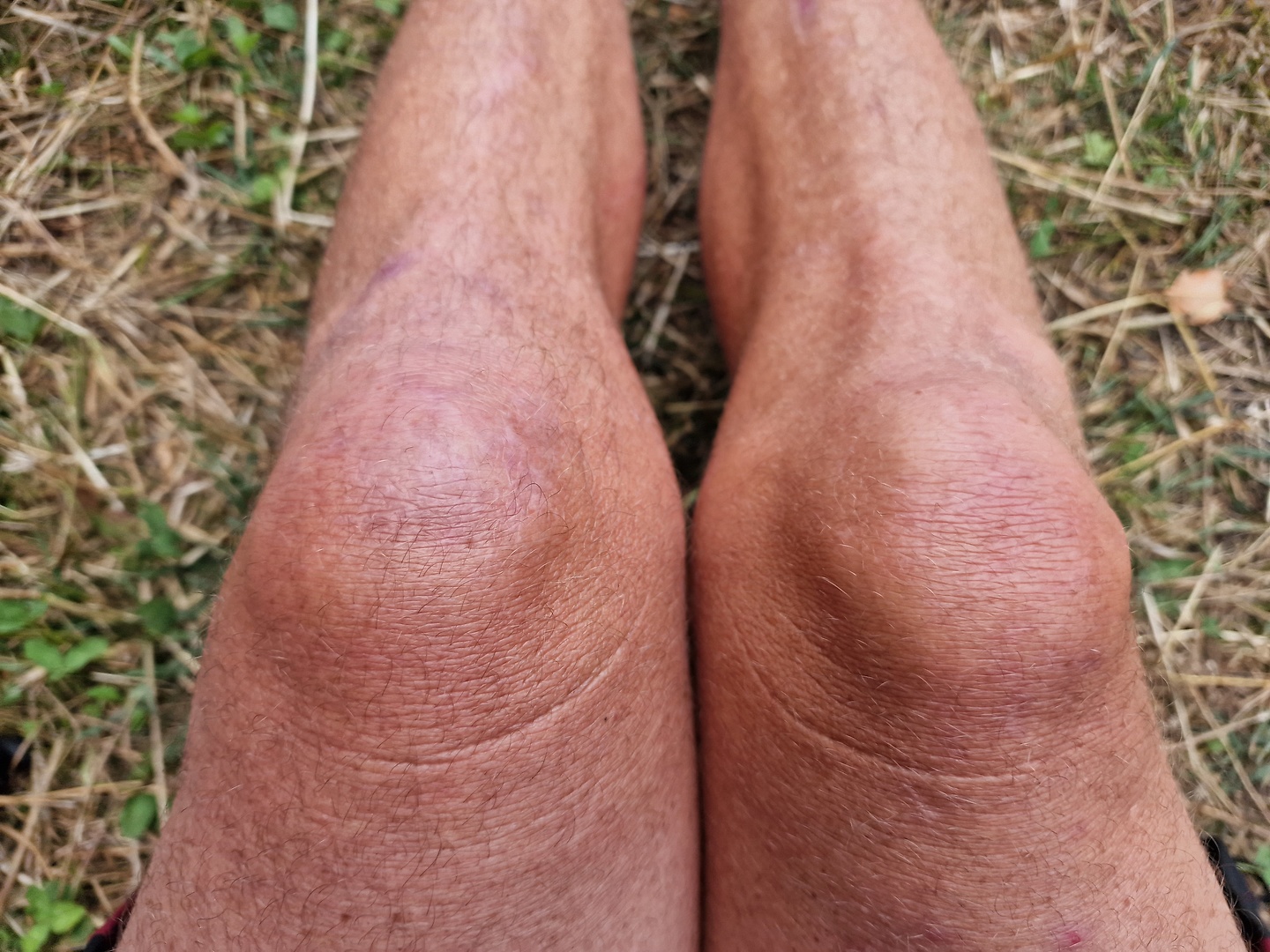 vielha-knee.jpg